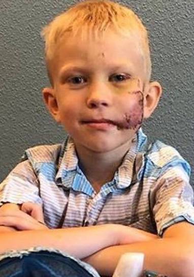 Un bambino di 6 anni ha salvato sua sorella dall’attacco di un cane